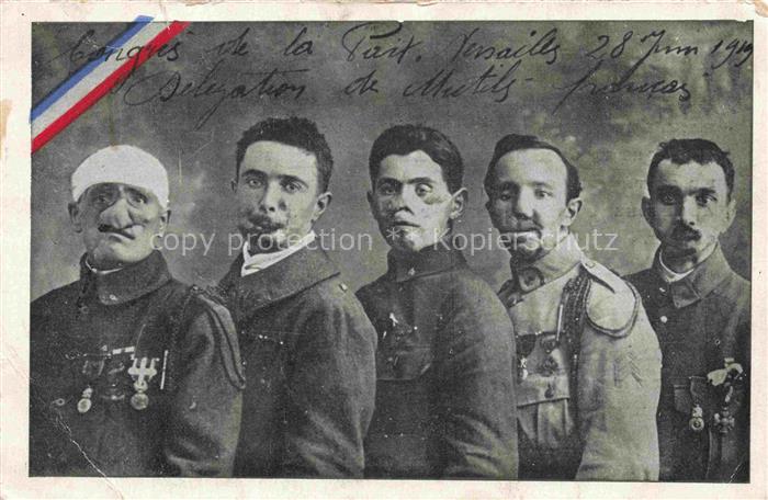 Militaria France Soldaten Blesses Face De Strasbourg