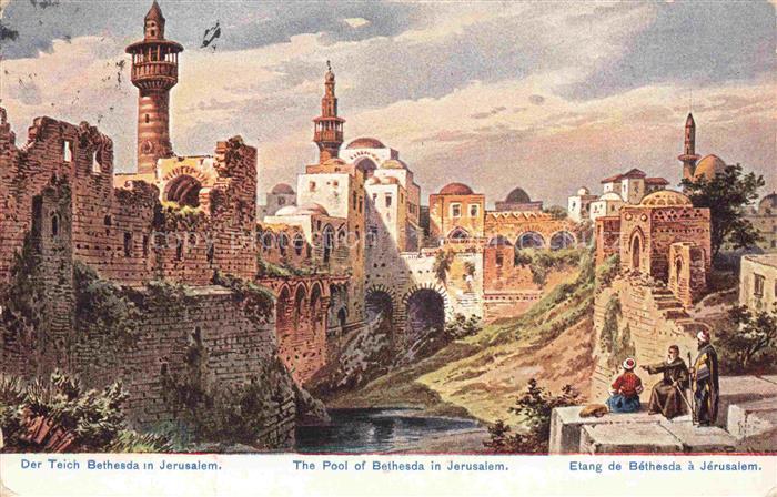 Bethesda Israel Der Teich